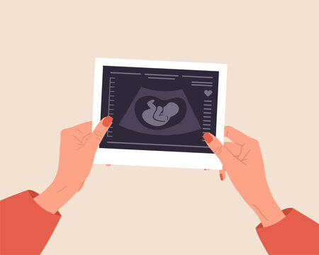 Ultrasound of baby. Female hands holding fetus silhouette photo. Embryo in womb. Pregnancy screening. Baby health diagnostic. Sonography or ultrasonography concept. Cartoon vector illustration.