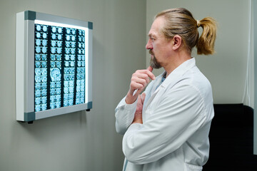 Side view of pensive mature male radiologist looking at ct scan of patient brain hanging on wall...