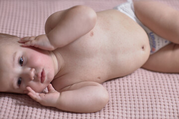 Roseola of the course of the disease in the baby, rash on the skin, the baby is capricious and...