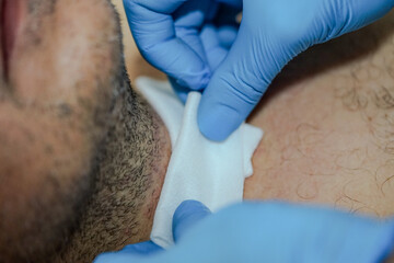 The wound from the thyroid operation is healed and covered for protection and recovery with gauze...