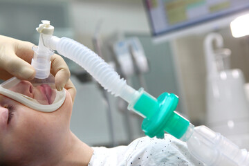A child with an oxygen mask on his face. Preparing the child for anesthesia. Dental surgery under general anesthesia. Surgical intervention. Dental treatment under general anesthesia.