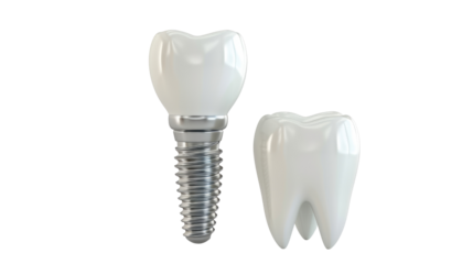 Tooth and dental implant isolated on transparent background