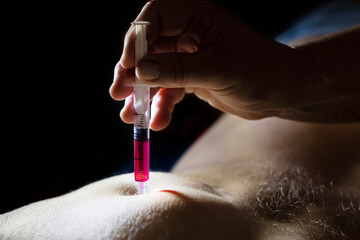 Injecting vitamin B with syringe - close up shallow focus