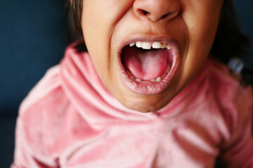 close up of child screaming at home 