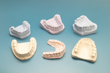 Many Die Stone, Plaster Cast Molds Of The Upper And Lower Jaws And Teeth With A Pliable Imprint In Dental Lab On Blue Background. Denture. Dental Gypsum Model, Prosthetics. Horizontal.