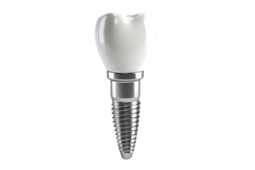 Implant isolated on transparent background