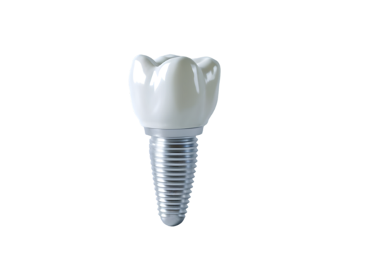 Implant isolated on transparent background