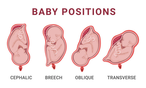 Baby positions in uterus during pregnancy medical anatomy gynecology scheme vector flat