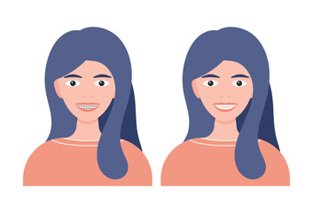 Woman with braces on her teeth vector illustration