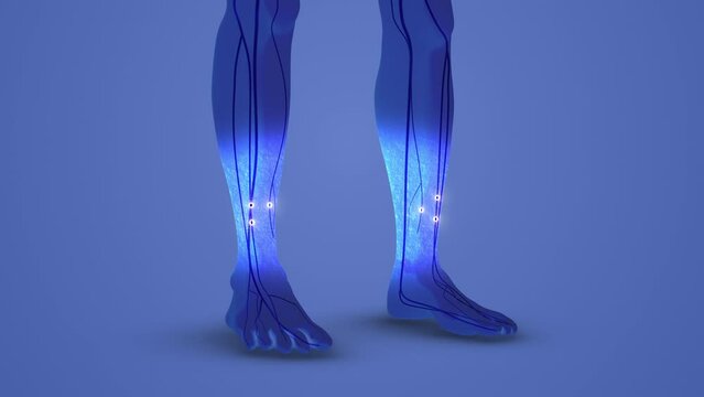 Feet carpal tunnel syndrome numbness medical cocept