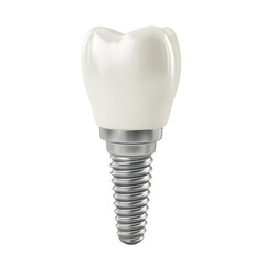 Dental implant isolated from white or transparent background