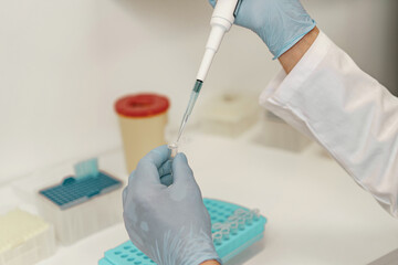 Close up of scientist is using micropipette for biochemical test analysis in medical laboratory