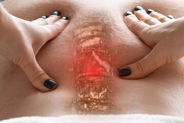 Women's hands massage a man's back and on the back you can see vertebrae, back pain, treatments and...