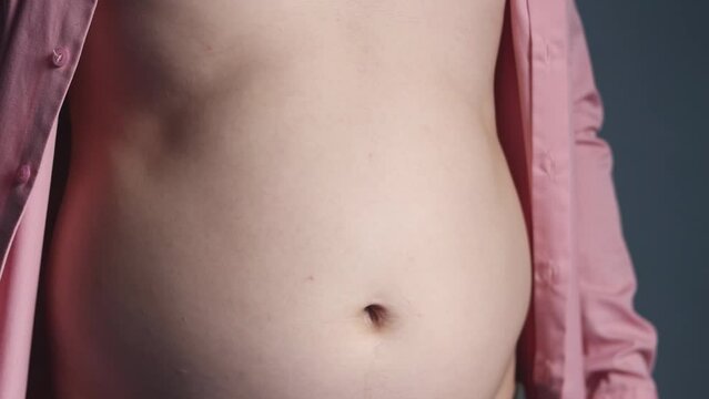 Closeup footage of overweight man take unbuttom shirt to show stomach over size and fat body wearing clothes concept, 4K 25fps hight resolution video