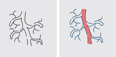 Jobs or activities that require long periods of standing or sitting may hinder proper blood flow in the legs, contributing to the development of varicose veins