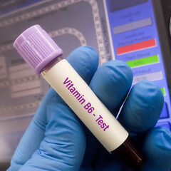 Test tube with blood sample for vitamin B6(Pyridoxal 5-Phosphate) test, for vitamin B6 deficiency...