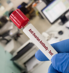 Naklejka premium Blood sample for Anti Ovarian Antibody test to diagnose Female Infertility as well as during and after the infertility treatment.