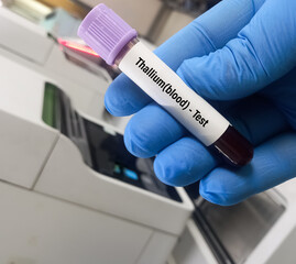 Hand holding blood sample for Thallium blood test, as a biomarker of acute thallium exposure.