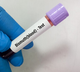 Blood sample for Bismuth (heavy metal) test, toxic metal. Diagnosis of Bismuth toxicity.