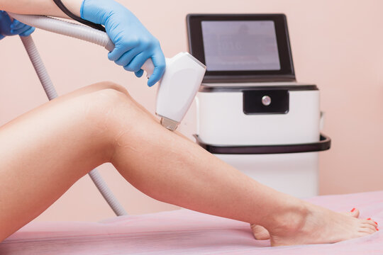 Laser hair removal on legs. Getting rid of unwanted body hair, body care, removal of unwanted hair, cosmetology. Beautiful female legs.
