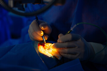 Surgery hospital process close up. Operating equipment technologies.