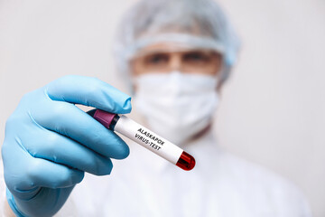 A medical worker holds a test tube with Alaskapox virus infected blood sample in his hands,hands in...