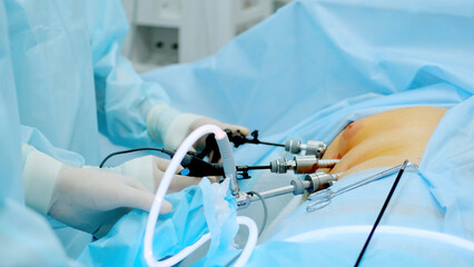Operating room, team of surgeons performing laparoscopic intervention. Modern medicine, medical equipment in hospital. Laparoscope instruments. Doctors use endo-instruments and video cameras