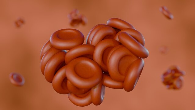 3d rendering of agglutination or hemagglutination, is an immune response when erythrocytes clump together. 