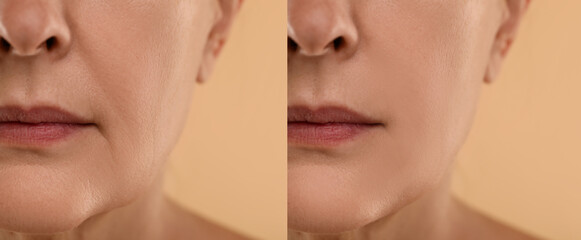 Obraz premium Aging skin changes. Woman showing face before and after rejuvenation, closeup. Collage comparing skin condition