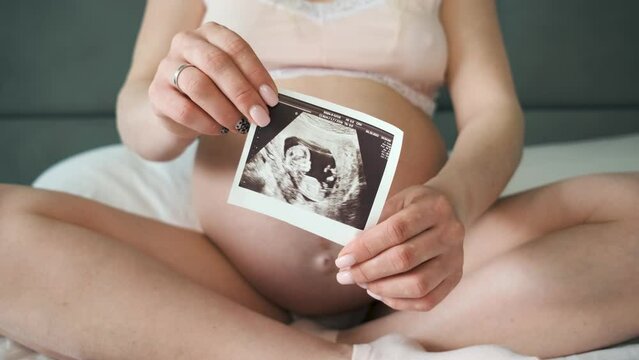 The pregnant girl holding an ultrasound picture in her hands while sitting on the bed	
