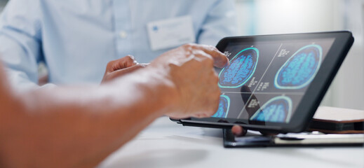 Doctor, hands and tablet with brain scan for patient, consultation or examination results at...