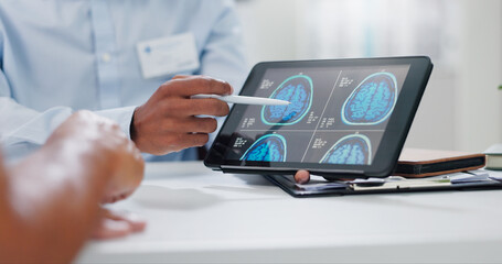 Doctor, hands and tablet with brain scan for patient, consultation or examination results at...