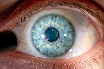 Photographer reflects in Pupil of Male Blue Colored Eye with Yellow Pigment Spots. Close Up....