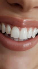 Fototapeta premium A close-up photograph capturing a womans smile with white, healthy teeth Bright White Healthy Smile Dental.