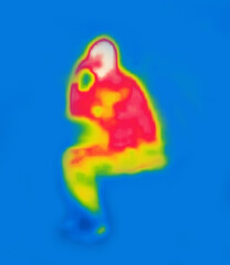 The person sitting on the bench is talking on the phone. The image from thermal imager device