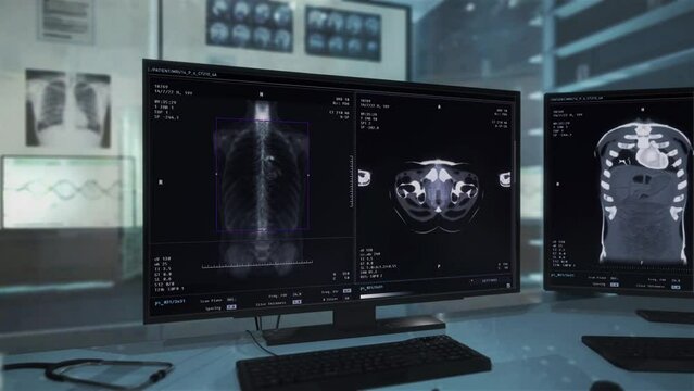 Health care technology scanning the chest of the sick person at a hospital. Health care technology examining the organs of the ill patient. Health care technology analysing the body condition.