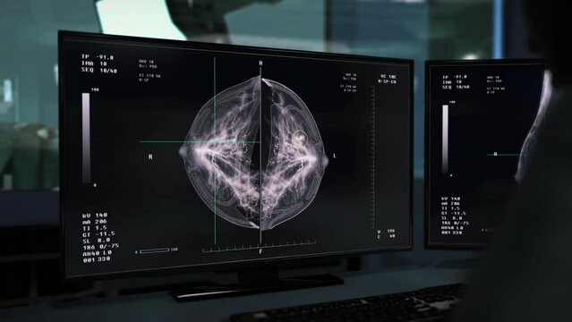 Analysing the female patient breast health during the medical hospital checkup. Using the Laboratory system on a checkup of the womans breast health. Breast health examination in a checkup procedure.