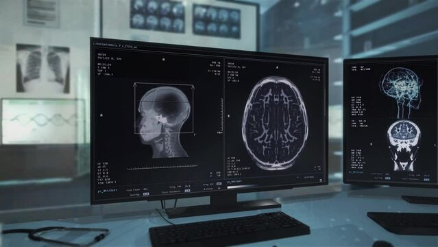 Computer Screen Shows Health Inspection System Monitoring Condition Of Organ. Innovative Medical System For Brain Imaging. Screening System Monitors Organ Health. Organ X-ray Check. Hospital
