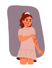 Person with skin disease. Girl with red spots at skin. Dermatological problems and illness. Template and layout. Cartoon flat vector illustration isolated on white background