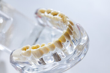 Teeth education model. Shallow dof