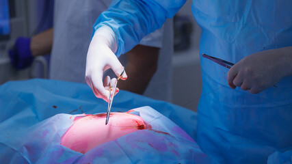Closeup process with tweezers and clamp. Surgery doctor sews up punctures in abdominal cavity with...
