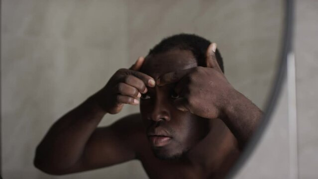 Close-up shot of mirror reflection of young African American man looking at his skin, then squeezing out pimple on forehead with fingers and wincing