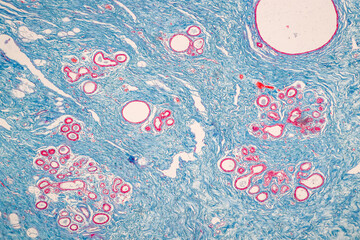 Mammary Human under the microscope in Lab.