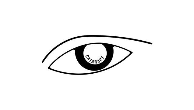 cataract symbol , black isolated silhouette