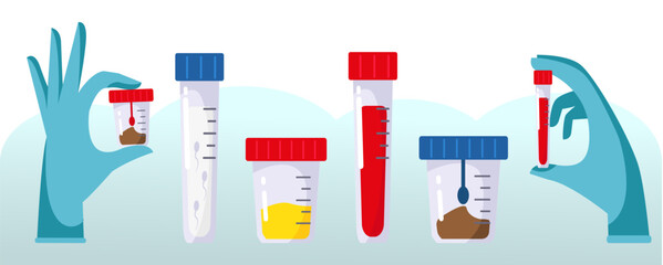 Set up the test tubes. Blood, urine, feces, spermogram. hands in medical gloves Medical equipment. Sample analysis. Plastic containers with biomaterial. Laboratory analysis. Flat design vector images.