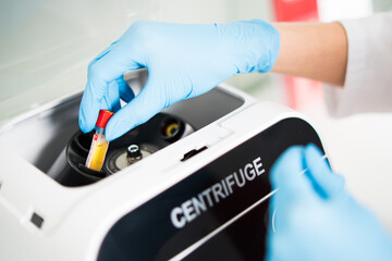 Close-up doctor insert blood test samples into centrifuge