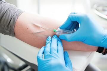 A nurse in the lab takes a blood test from a vein, a close-up plan without a face.