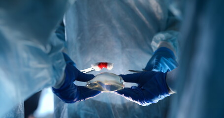 Close-up of plastic surgeon doing implantation procedure with implants. Practitioner performing...