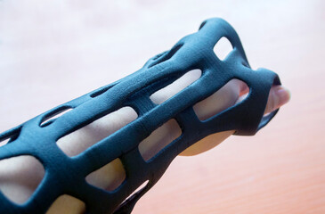 Hand arm splint corset prosthesis langet printed on 3D printer from molten plastic on hand. Medical...
