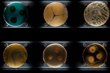 Different types of bacteria, mold and fungi in petri dishes
